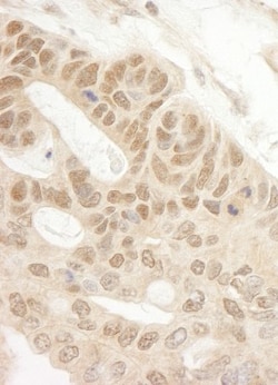 TIPRL Antibody, Novus Biologicals 0.1mL; Unlabeled:Antibodies, Polyclonal